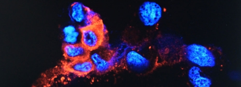 最新疫情通報(bào)：奧密克戎毒株擾動(dòng)全球 多國(guó)收緊入境防疫措施