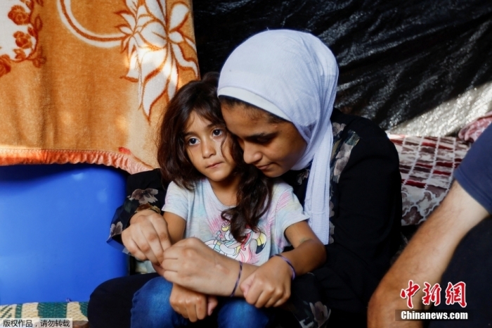 當(dāng)?shù)貢r間10月24日，在加沙地帶南部的汗尤尼斯，巴勒斯坦男子阿里·達(dá)巴一家人在避難所展示了他們的手環(huán)。阿里·達(dá)巴和妻子因擔(dān)心孩子們在襲擊中喪生，決定把他們分開，如遇到不幸，可以用手環(huán)認(rèn)出他們。